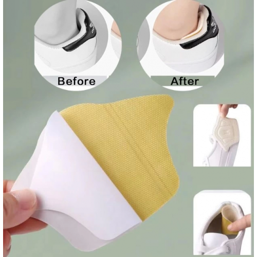 Pratik Taç Şekilli 10 Mm Topuk Daraltma Ve Vurma Önleyici Pratik Taç Şekilli 10 Mm Topuk Daraltma Ve Vurma Önleyici